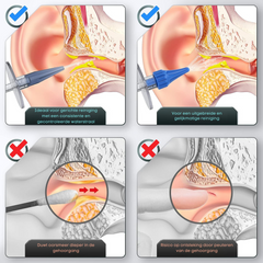 HAIDU Detergente per orecchie essenziale