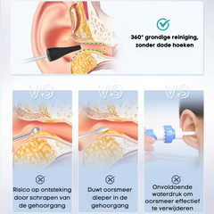 Sollievo per la pulizia delle orecchie HAIDU