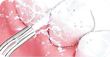 Alt Image