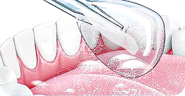 Alt Image