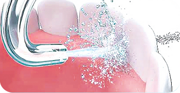 Alt Image